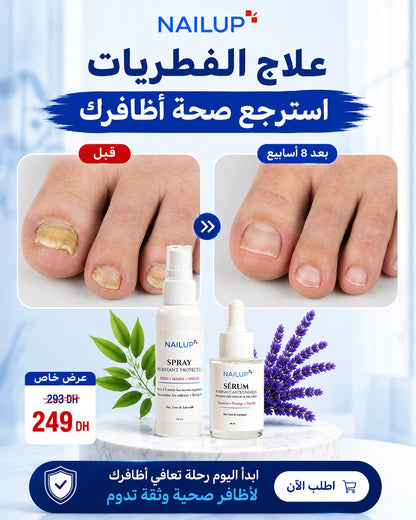 Pack Duo NailUp – Traitement des Champignons des Ongles