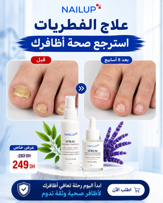 Pack Duo NailUp – Traitement des Champignons des Ongles